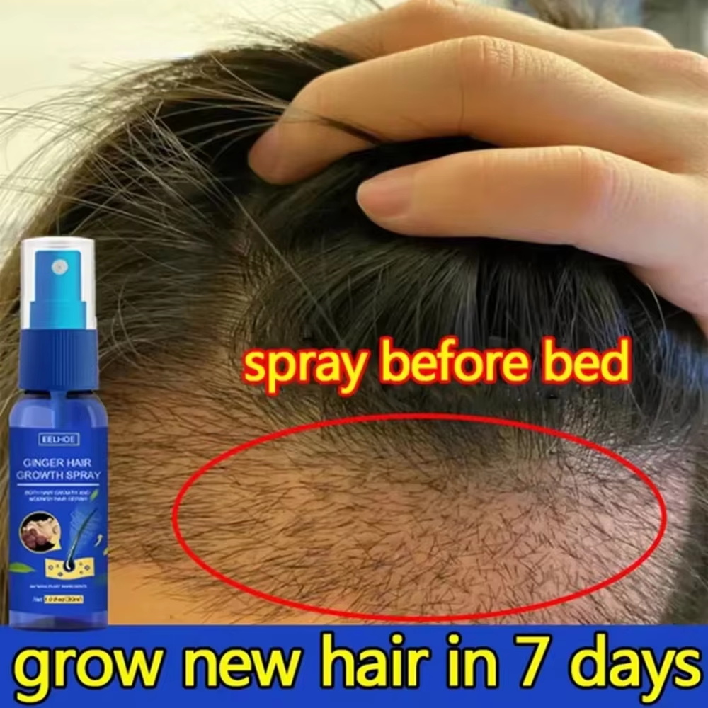 Fast Ginger Hair Growth Spray  - đánh giá và giá Hair Care Lotion